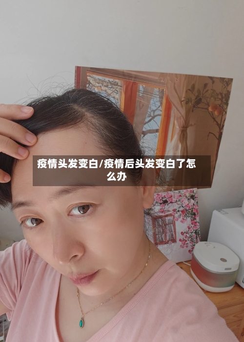 疫情头发变白/疫情后头发变白了怎么办
