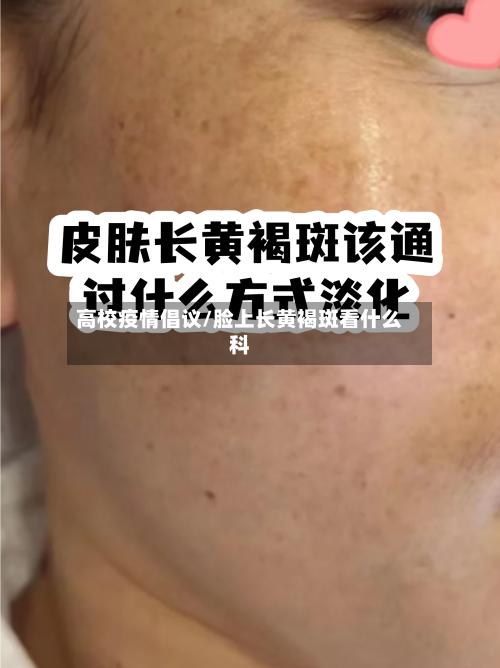 高校疫情倡议/脸上长黄褐斑看什么科-第2张图片