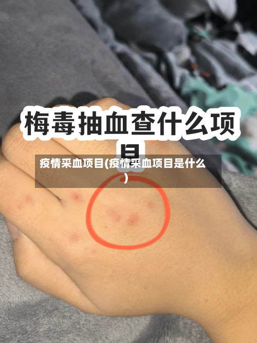 疫情采血项目(疫情采血项目是什么)-第3张图片