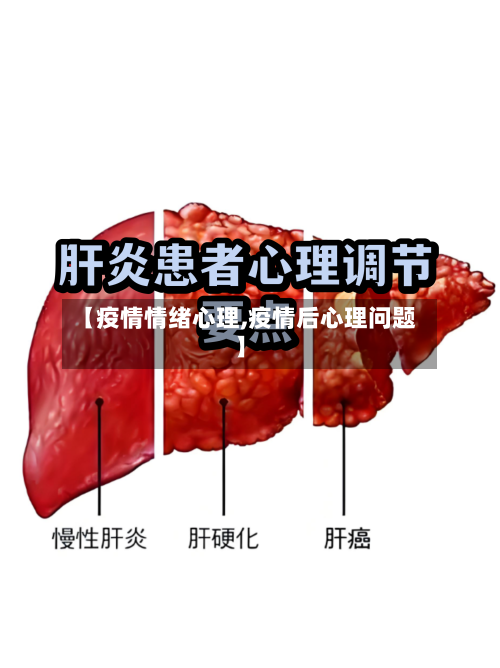【疫情情绪心理,疫情后心理问题】
