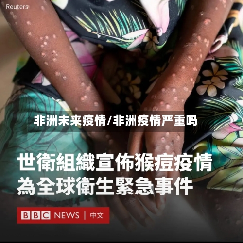 非洲未来疫情/非洲疫情严重吗-第2张图片