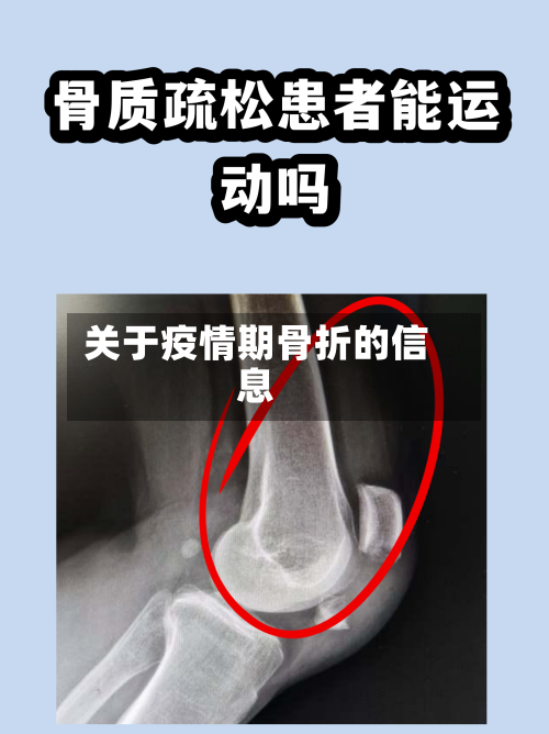 关于疫情期骨折的信息