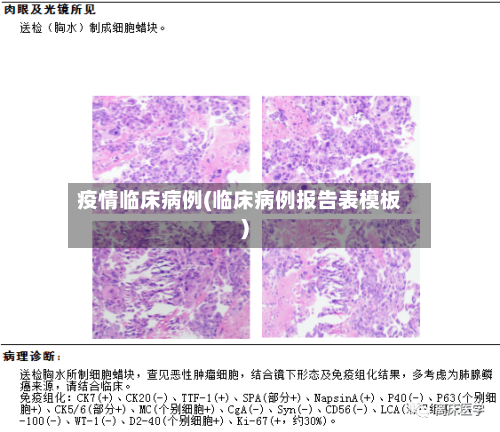 疫情临床病例(临床病例报告表模板)