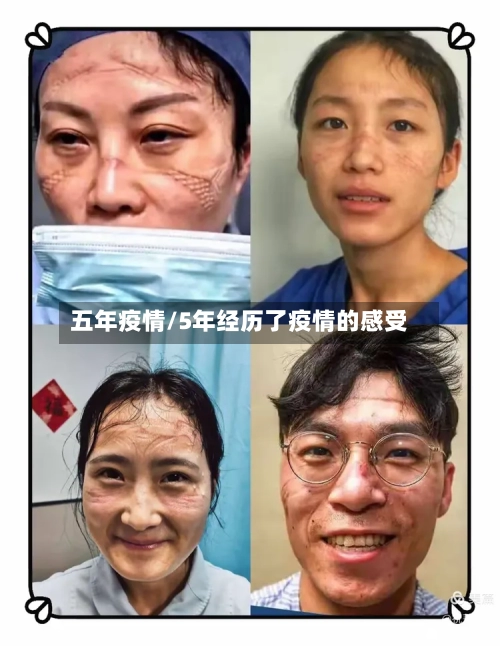 五年疫情/5年经历了疫情的感受